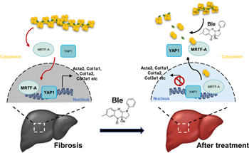 Drug treatment moves closer for fibrosis, the condition behind a third of natural deaths